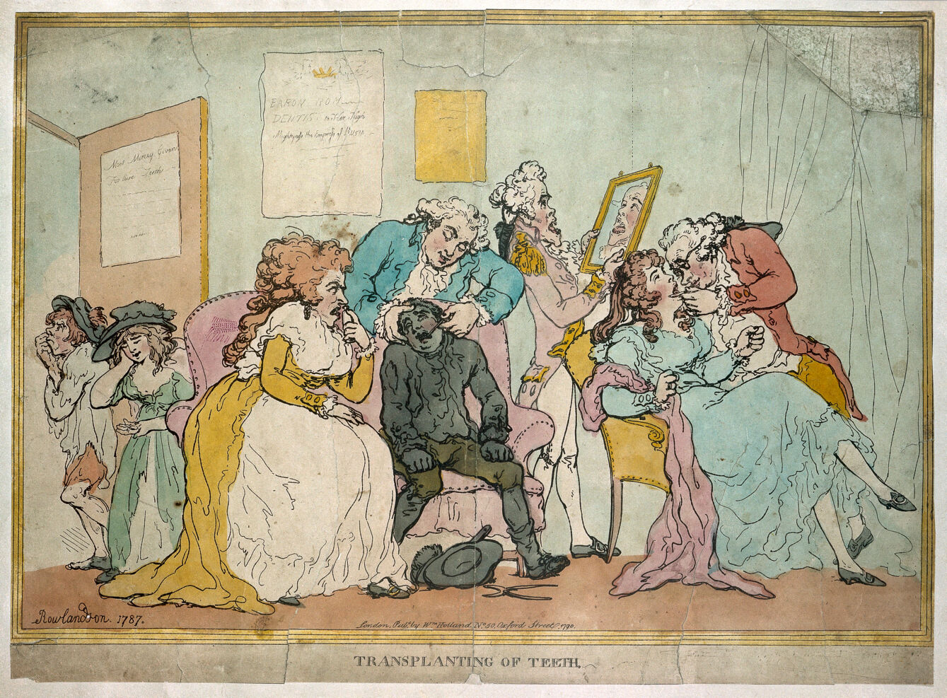 Illustration d’époque de Thomas Rowlandson intitulée « Transplanting of teeth », datant de 1787