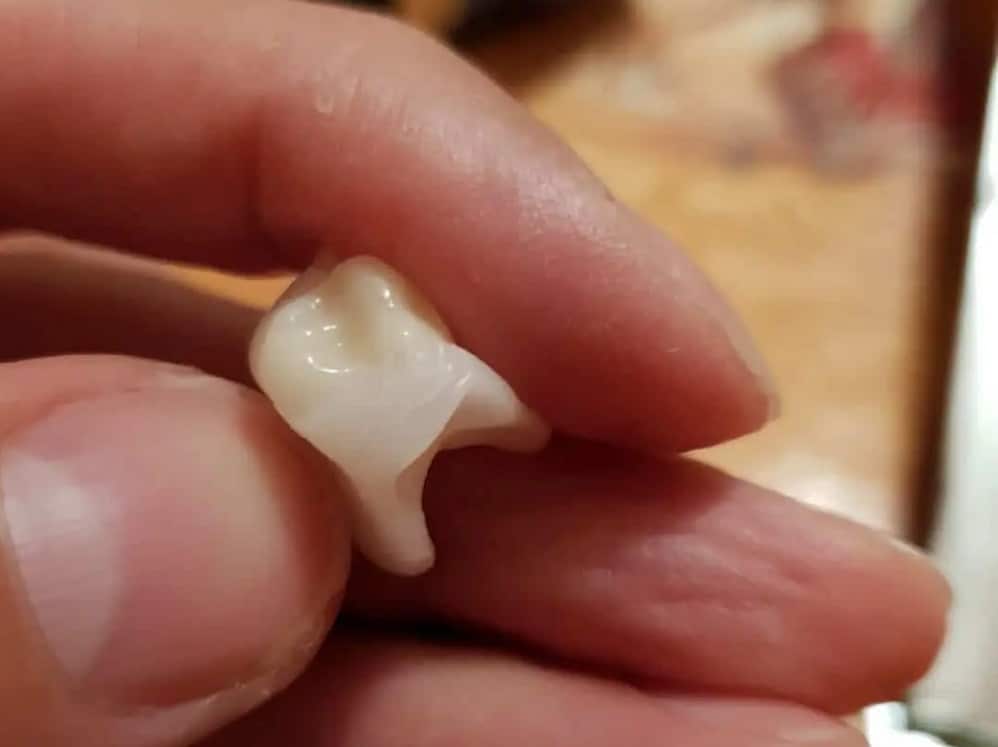 Photographie Denticor : une couronne et son support DentiFlex.