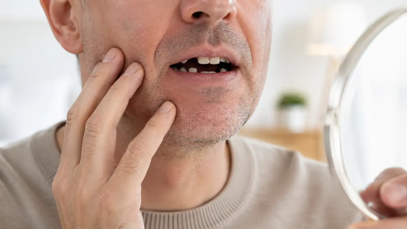 Plusieurs dents manquantes et le moment de décider par où et comment commencer