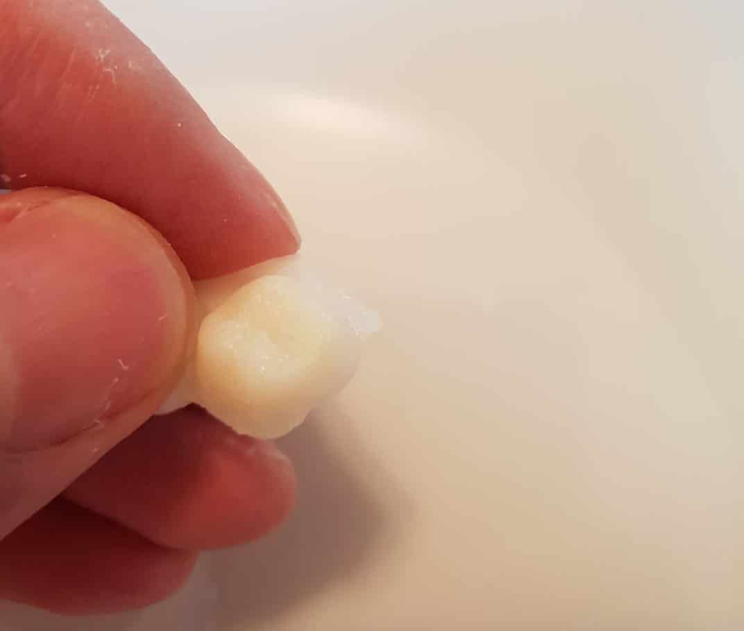 Premier prototype de prothèse dentaire Denticor