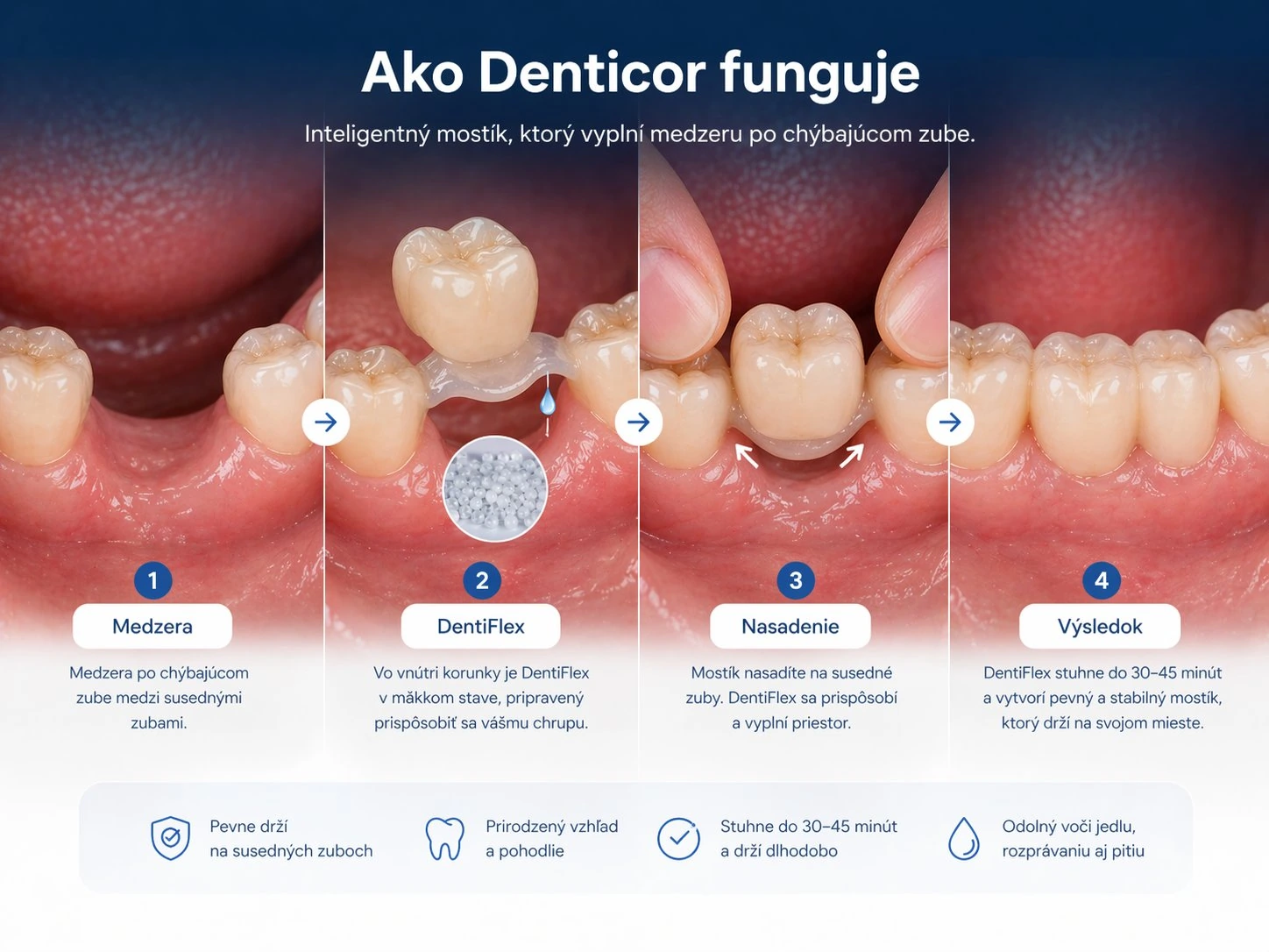 Comment fonctionne Denticor en cas d’absence de trois dents supérieures postérieures