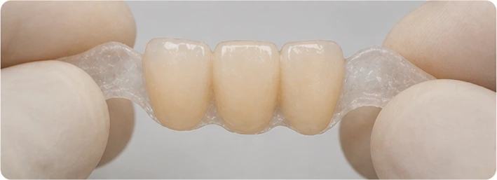 Trois couronnes insérées dans le DentiFlex