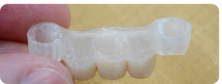 Démonstration de la mise en place du Denticor pour une canine inférieure et deux prémolaires : pose de la prothèse et mise en forme de son appui contre les dents voisines