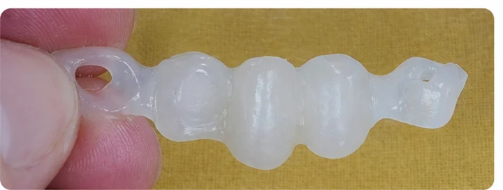 Procédure visuelle pour deux prémolaires et une molaire du haut – principe de mise en place du bridge Denticor avec de nouvelles dents et de son ajustement aux dents adjacentes