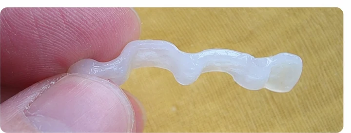 Démonstration de la pose du Denticor : positionnement de la prothèse de remplacement et mise en forme de son support DentiFlex · 2