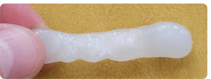 Démonstration de la pose du Denticor : positionnement de la prothèse de remplacement et mise en forme de son support DentiFlex · 2