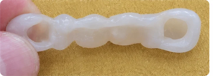Démonstration de la pose du Denticor : positionnement de la prothèse de remplacement et mise en forme de son support DentiFlex · 4