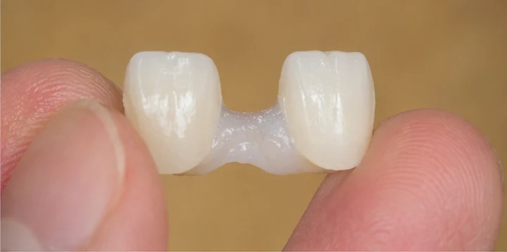 Procédure visuelle de pose et d'ajustement de la prothèse – dent canine inférieure et prémolaire